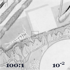 100:1